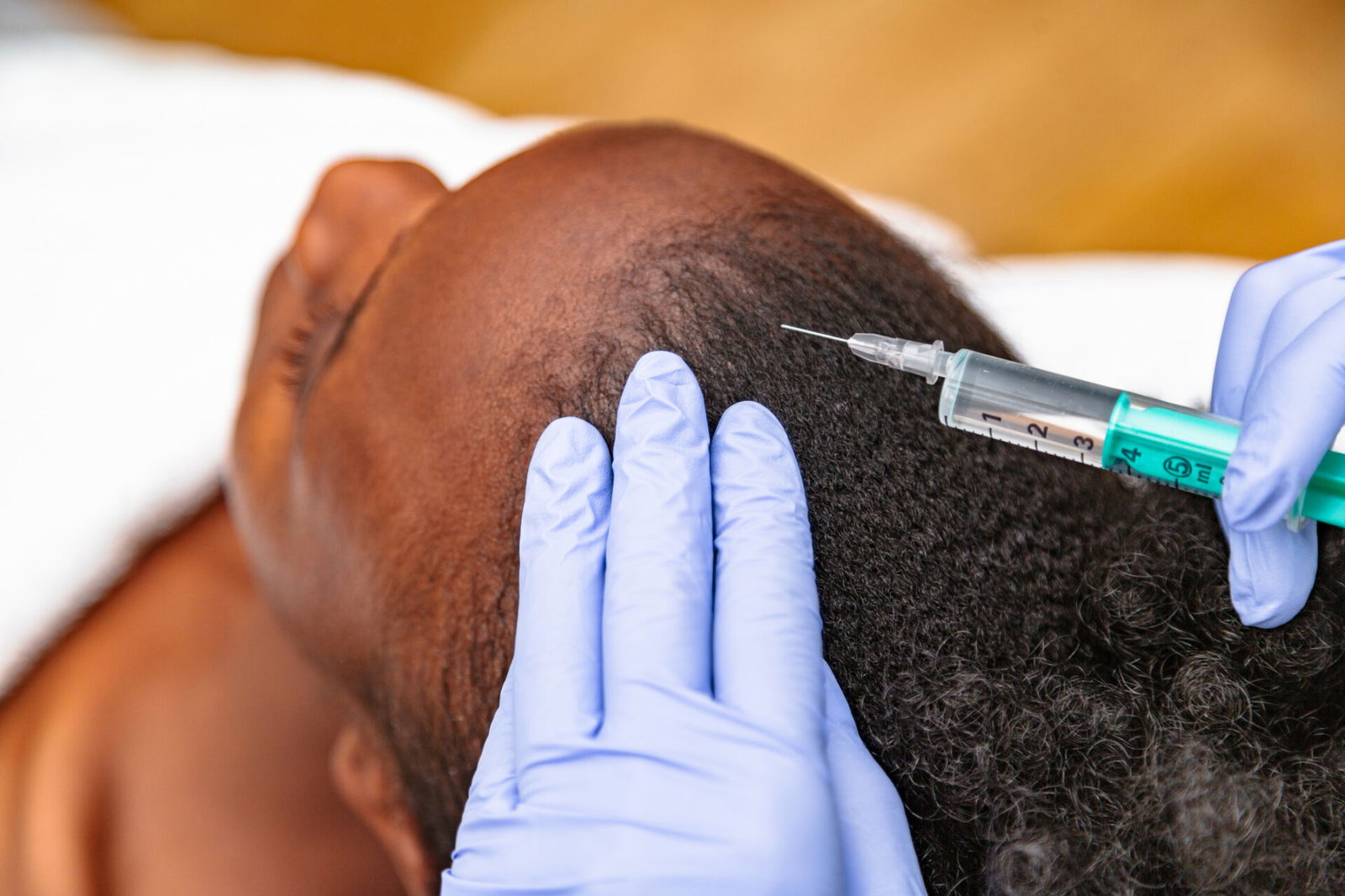 Black Women Are Bigger Spenders On Botox To Avoid Sweaty Edges