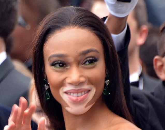 Winnie Harlow Makes History As First Person With Vitiligo Honored With A Madame Tussauds’ Wax Figure
